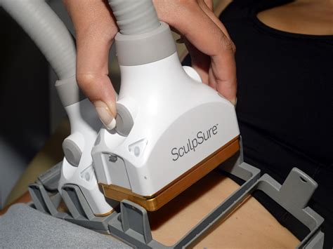 SculpSure vs. Coolsculpting — Sloane Stecker Physical Therapy