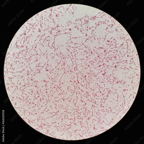 Bacilli Bacteria Microscope