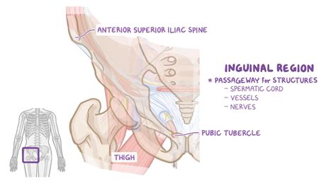 Female Inguinal Hernia Anatomy