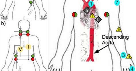 Physiological Measurement - IPEM