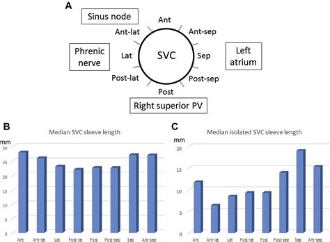 SVC Mapping Using an Ultra-High Resolution 3-Dimensional Mapping System in Patients With and ...