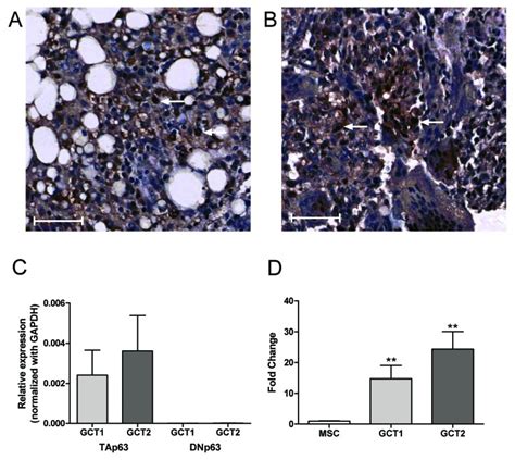 p63 protein and gene expression in GCT. (A and B) Immunostaining for ...