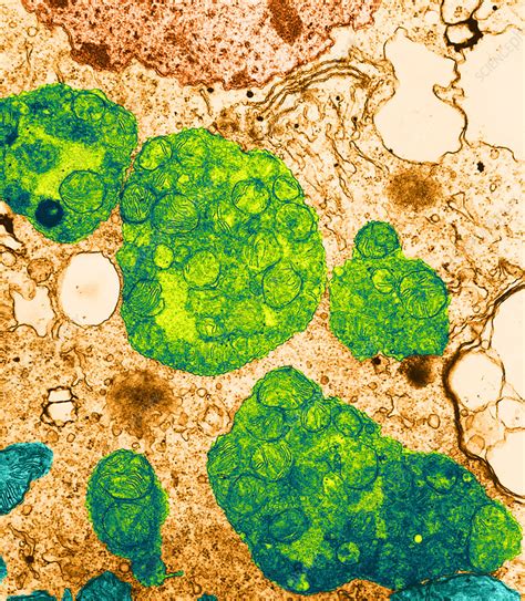 Lysosome Electron Micrograph