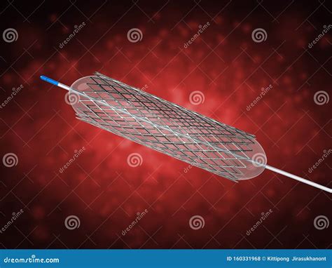 Stent for Balloon Angioplasty Stock Illustration - Illustration of coronary, silver: 160331968