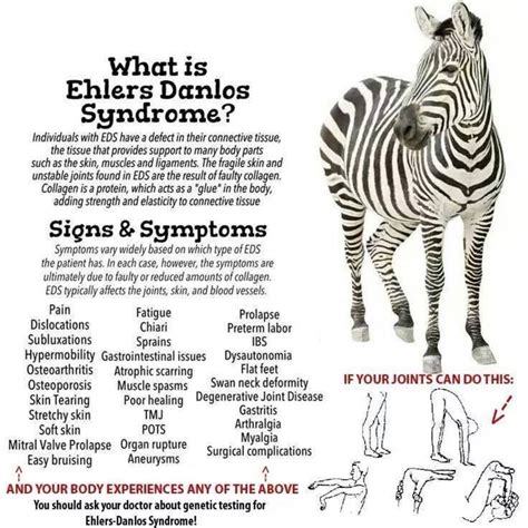 Ehlers-Danlos Syndrome | PaReflectionEd