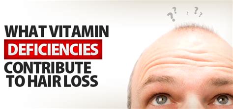 16 Vitamin Deficiencies that Lead to Hair Loss | HealDove