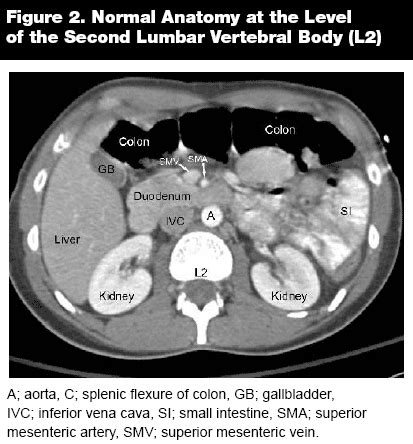 Normal Ct Scan Abdomen