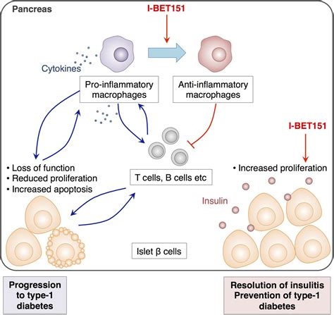 Autoimmunity: Treating type-1 diabetes with an epigenetic drug | eLife