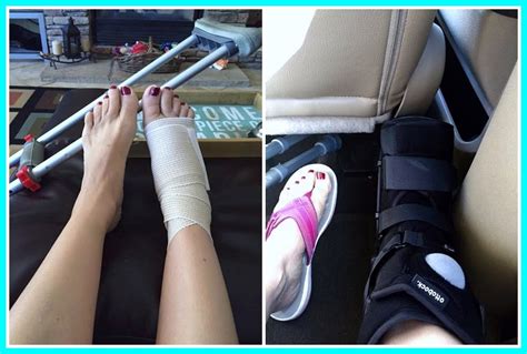 injured foot - ManagedMoms.com