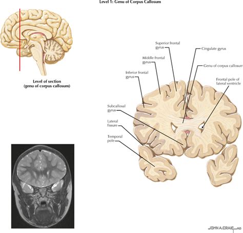 TELENCEPHALON | Neupsy Key