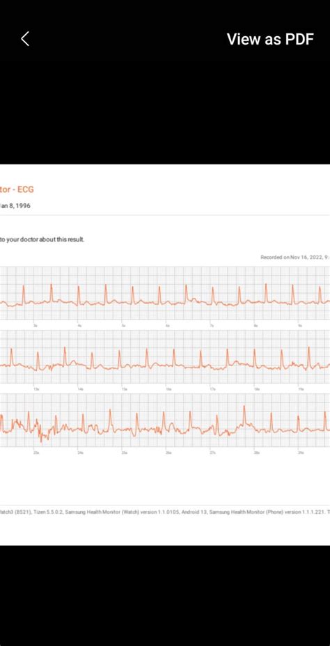 is this Afib? my galaxy watch keeps telling me it is : r/smartwatch