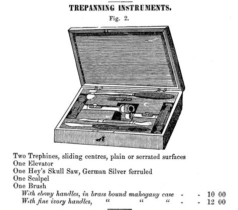 A Look at Trephining | Guardian Of The Artifacts | fredericknewspost.com