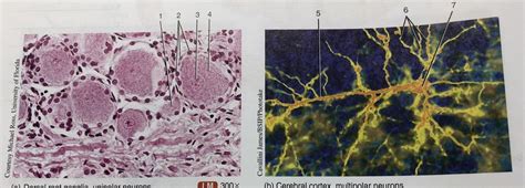 Sectional View Of The Dorsal Root Ganglion In Cerebral Cortex | Hot Sex ...