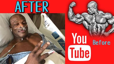 Steroids Side Effects | Examples - YouTube