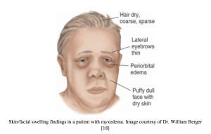 emDOCs.net – Emergency Medicine EducationFacial swelling: Etiologies, Presentations, Evaluation ...