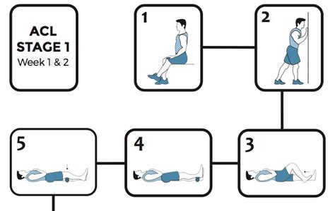 ACL: 7 tips to make recovery from ACL surgery easier - Dr Colvin Perth