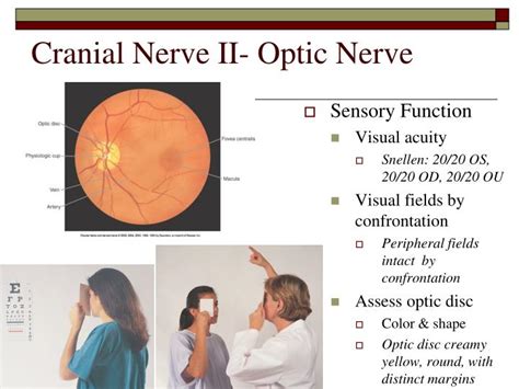 Optic Nerve