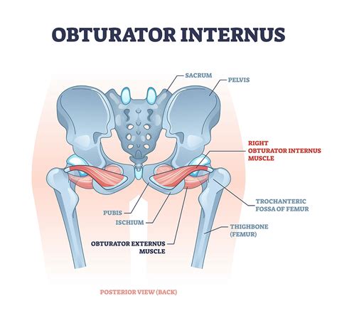 Obturator Internus (OI) Dysfunction