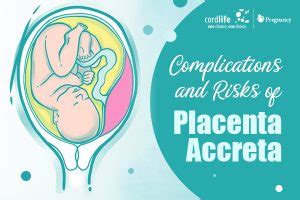 Complications and Risks of Placenta Accreta - Cordlife India