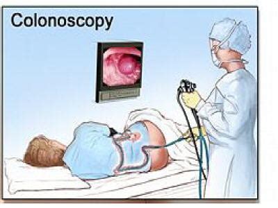 Colonoscopy - Procedure, Preparation, Test, Risks | Diseases Pictures