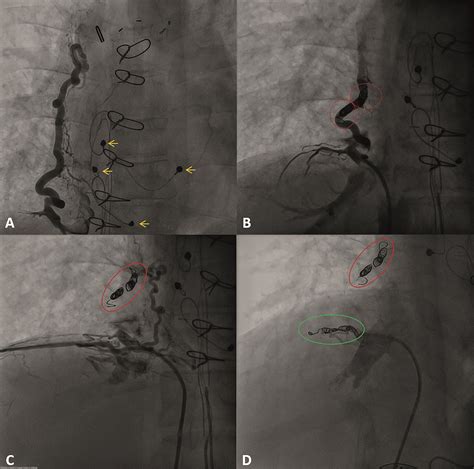 European Society of Cardiology Journals (@ESC_Journals) / Twitter