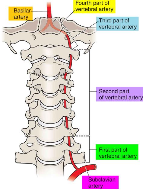 Vertebral Artery Segments, Stenosis and Artery Dissection Symptoms