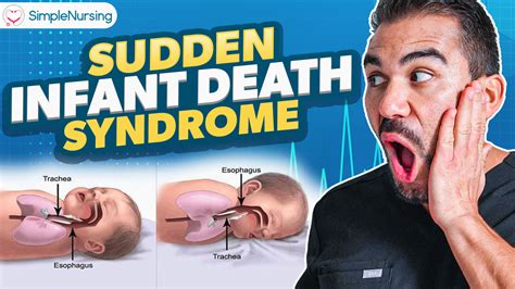 Sudden Infant Death Syndrome (SIDS) NCLEX Study Guide