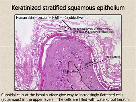 Identification Of A Nonkeratinized Stratified Squamous