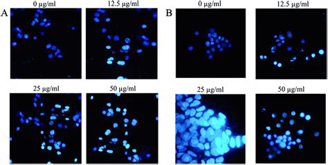 Morphology of K562 cells (A) and MDA-MB-231 cells (B) treated with ...