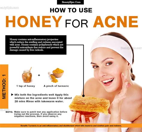 7 Effective Ways To Get Rid Of Acne With Honey