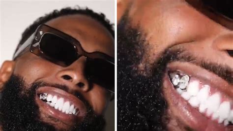 Odell Beckham Drops $1.8 Million On Iced-Out Teeth, 13 Carat Diamonds!