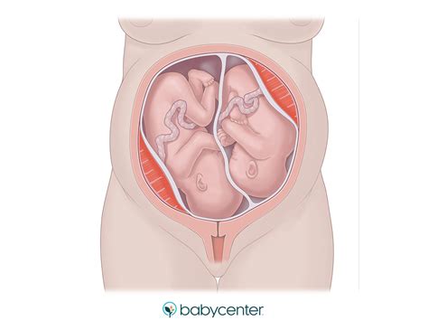 Fetal presentation of twins before birth | BabyCenter