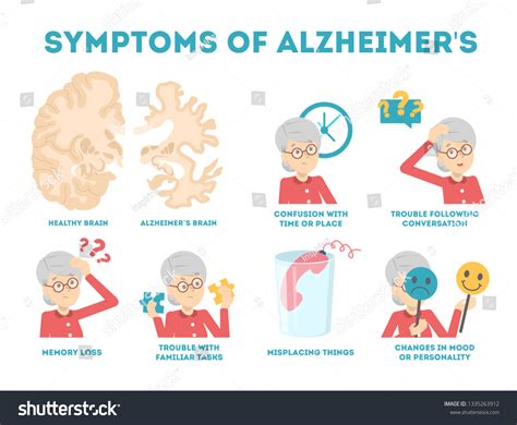 Alzheimer Disease Symptoms Infographic Memory Loss Stock Vector ...