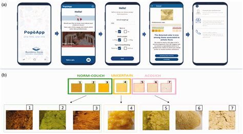 A novel mobile phone application for infant stool color recognition: An ...