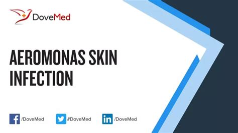 Aeromonas Skin Infection - DoveMed