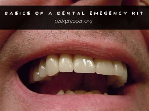 How to Build Your Own Emergency Dental Supply Kit (+Content List)