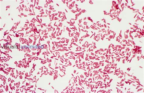 Escherichia coli or E. coli | Visuals Unlimited