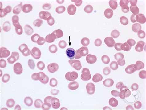 Nucleated red blood cell - 1.