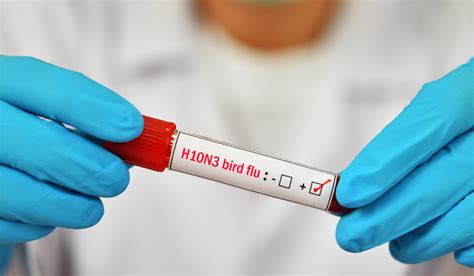 Vaccine Makers Prepare Bird Flu Shots ‘Just in Case’