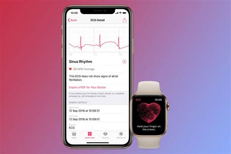 What is Apple Watch ECG and how do you set it up?