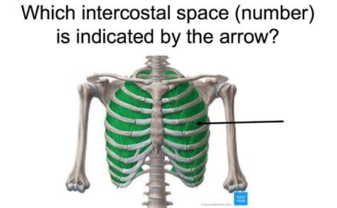 Solved Which intercostal space (number) is indicated by the | Chegg.com