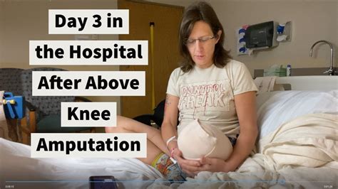 Above Knee Amputation Anatomy