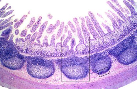 Microbiology (EXAM #2) CH. 15 Homework & Reading Questions Flashcards ...