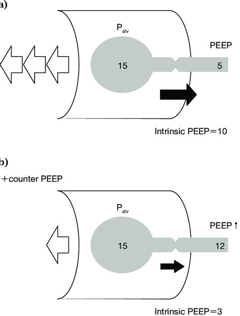 The effects of intrinsic PEEP to trigger the ventilator （a） At the ...