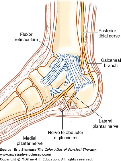 Tarsal Tunnel Syndrome | AccessMedicine Network