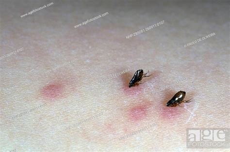 Cat flea, Ctenocephalides felis, biting on human Skin. Portugal, Stock Photo, Picture And Rights ...
