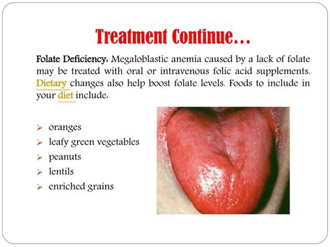 PPT - Megaloblastic Anaemia: Symptoms, causes, diagnosis, treatment and ...