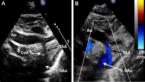 Echocardiography: an overview - Part II