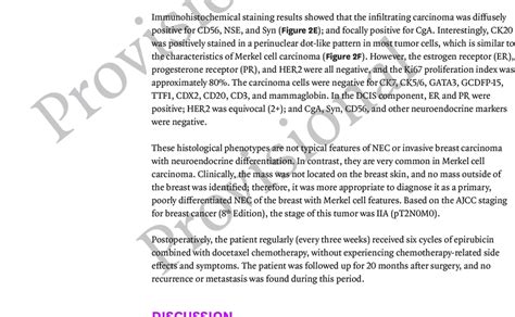 Histopathological characteristics of breast lesion. (A-D) Histology of... | Download Scientific ...