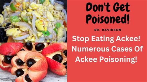 Symptoms of Ackee Poisoning and How to Identify Them Before It's Too ...